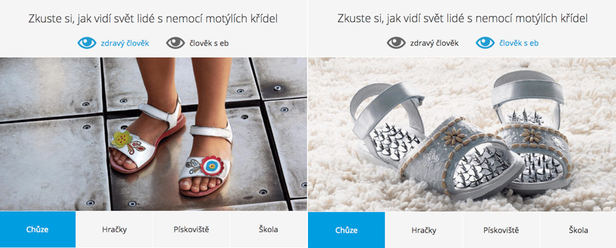 Jak přenést na lidi ty správné asociace a zároveň vysvětlit citlivé a složité téma? Neziskovce Debra se to podařilo. Na svém webu srovnává zážitek zdravého dítěte a dítěte s nemocí motýlích křídel pomocí sugestivních fotomontáží. Zdroj: Debra